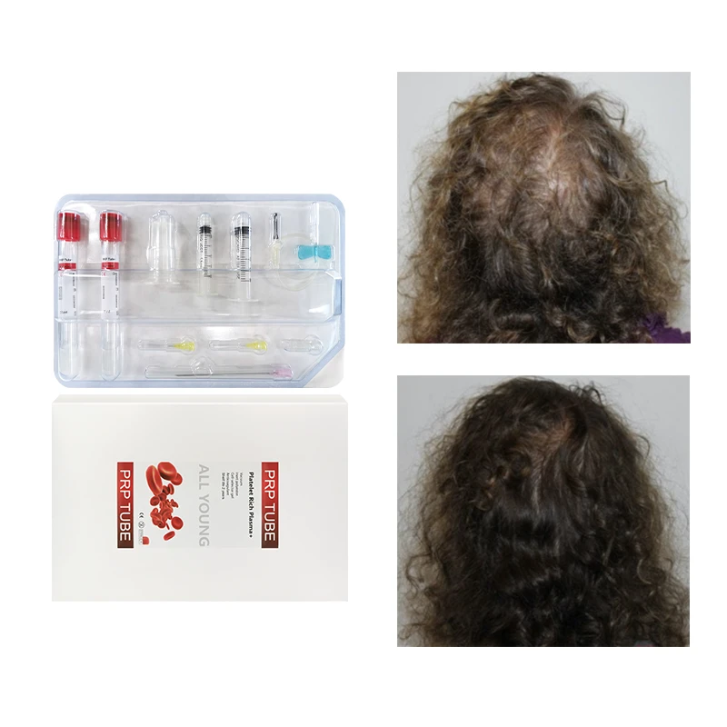 Корейский набор тюбиков ACD Gel Biotin PRP объемом 15 мл